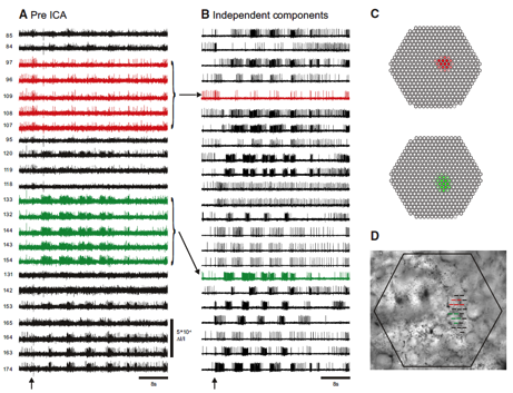 extracellular space